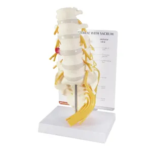 GPI Anatomicals - 5-Piece Vertebrae Model with Sacrum, Spine Model for Human Anatomy and Physiology Education, Anatomy Model for Doctor's Offices and Classrooms, Medical Learning Resources