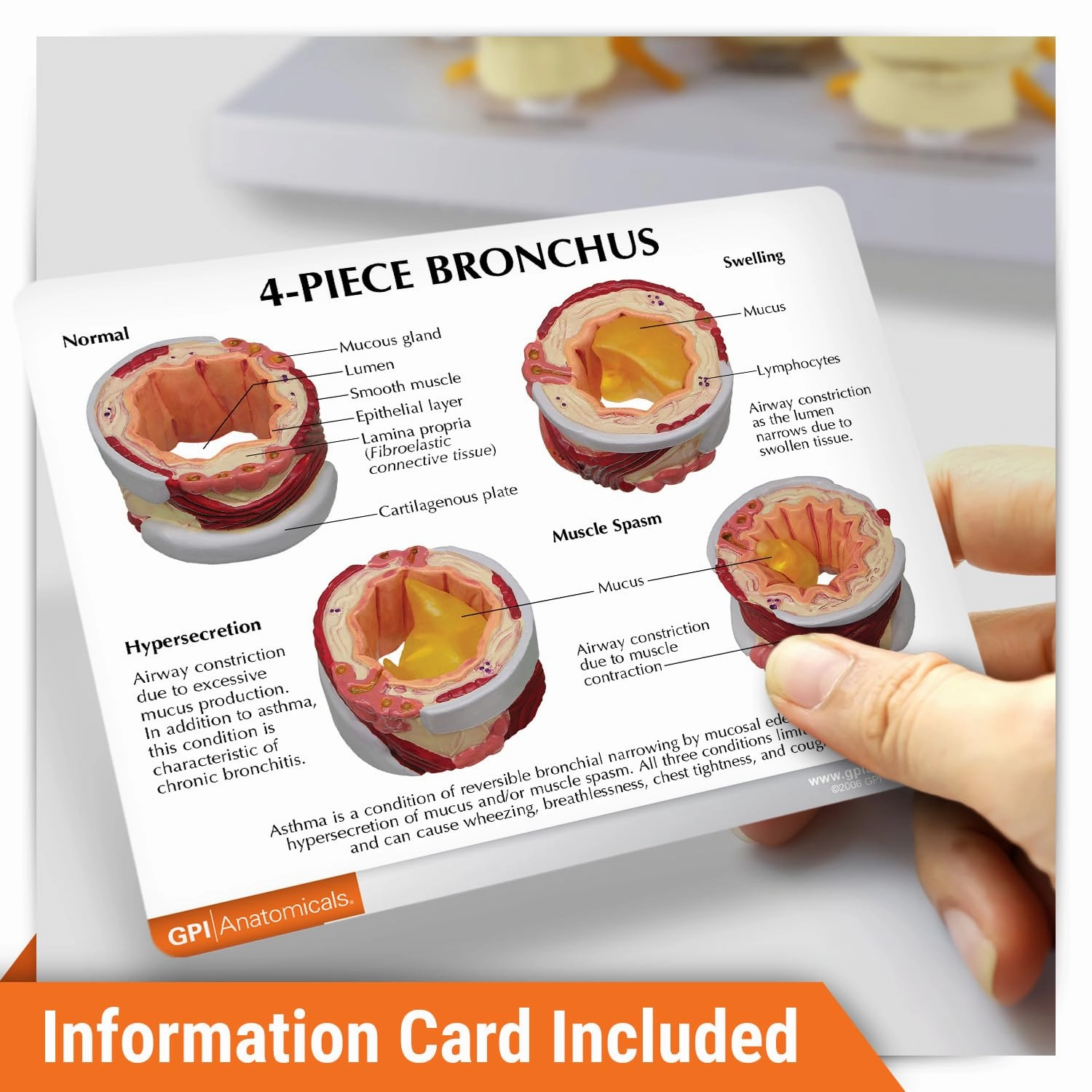 GPI Anatomicals - 4-Piece Bronchus Model, Replica of a Bronchus with Pathologies for Human Anatomy, Physiology Education, Anatomy Model for Doctor's Offices and Classrooms, Medical Learning Resources