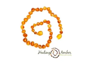 Healing Amber Baltic Amber Anklet/Bracelet - Raw Caramel